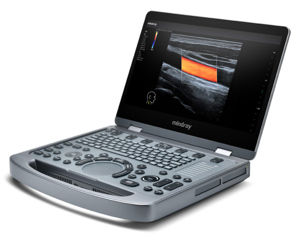 Mindray MX3 mobiles Farbdoppler-Ultraschallsystem schräg von links, mit Farbdoppler-Bild